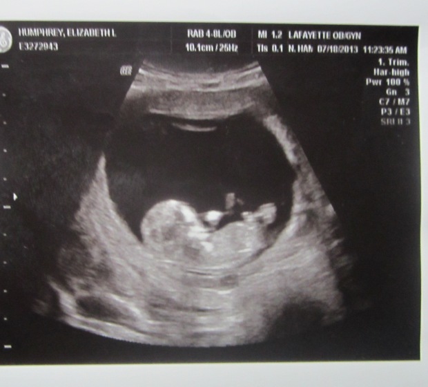 This is Baby H at 12 weeks. :-)