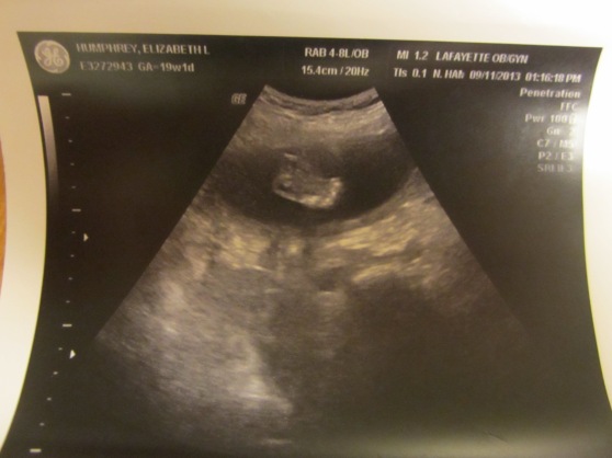 This is just so amazing to me...a perfectly formed, tiny little foot.
